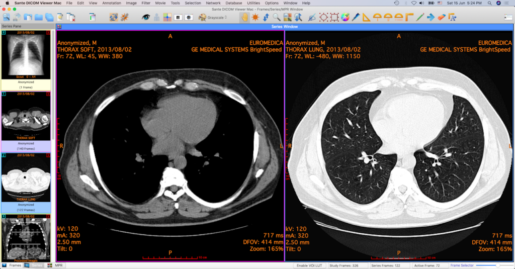 DICOM viewer Mac