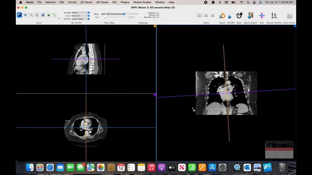 DICOM viewer Mac